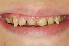 Before-slide4