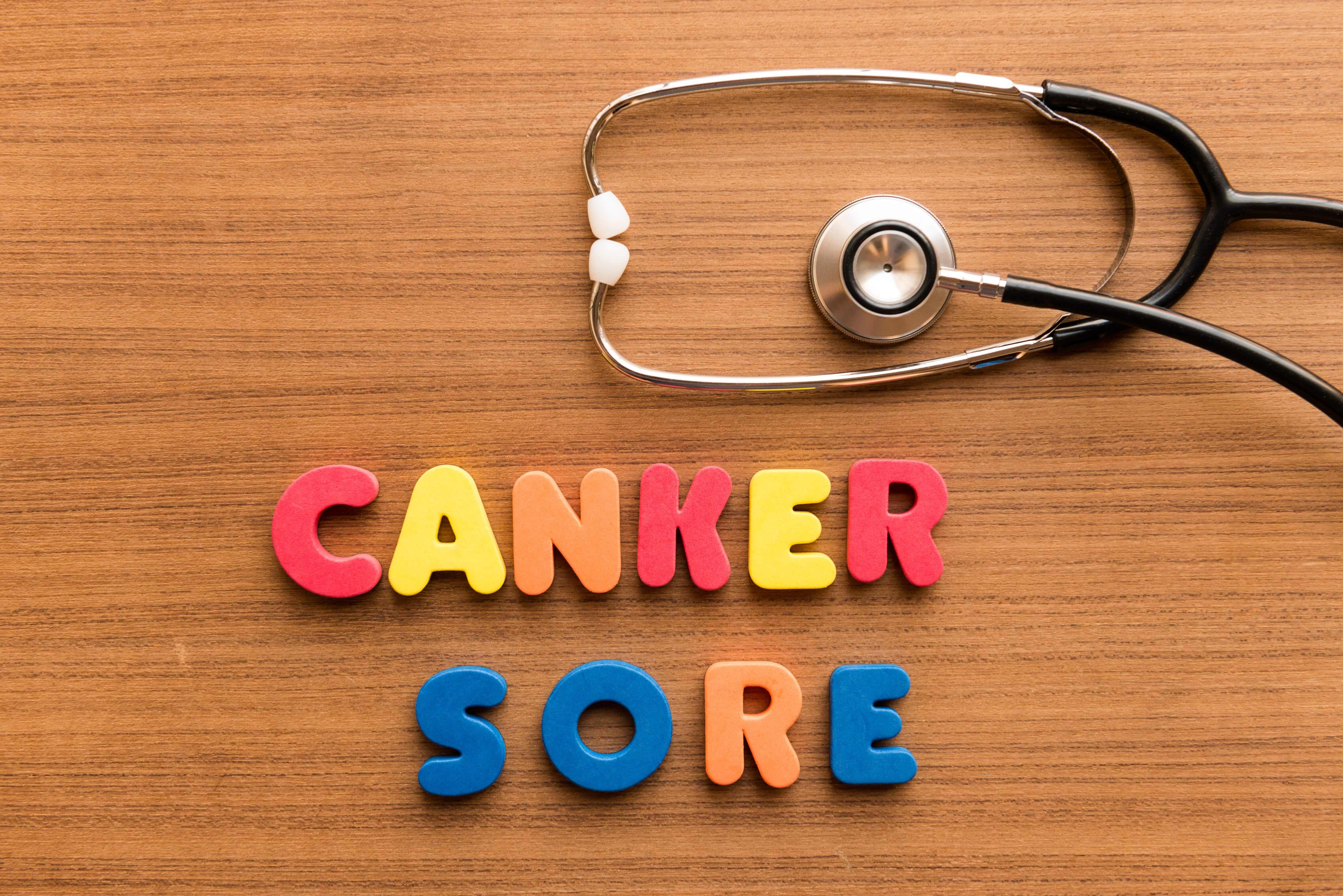 Canker Sore | Understand their Cause & Get Relief