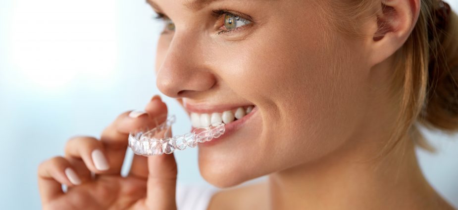 Invisalign Braces: Clear Aligners. Teeth Straightening. Invisible