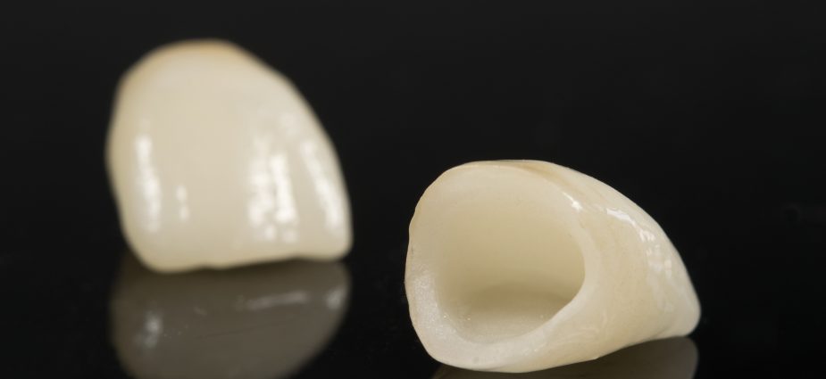 isolated dental crowns on a black background