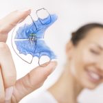 smiling female model showing off a blue dental retainer