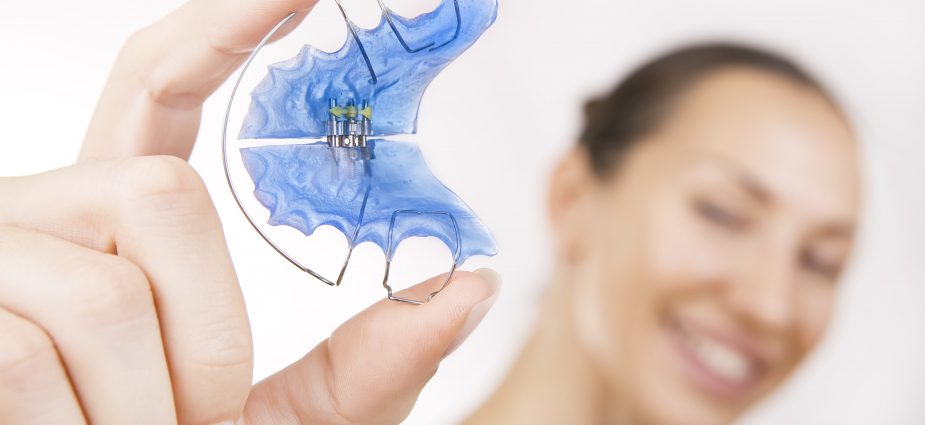 smiling female model showing off a blue dental retainer