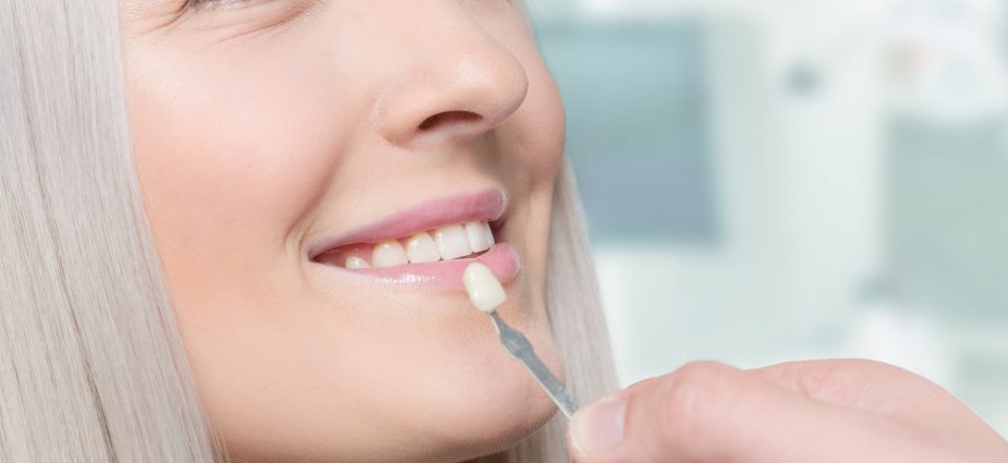 smiling female dental veneer patient evaluating options at consultation