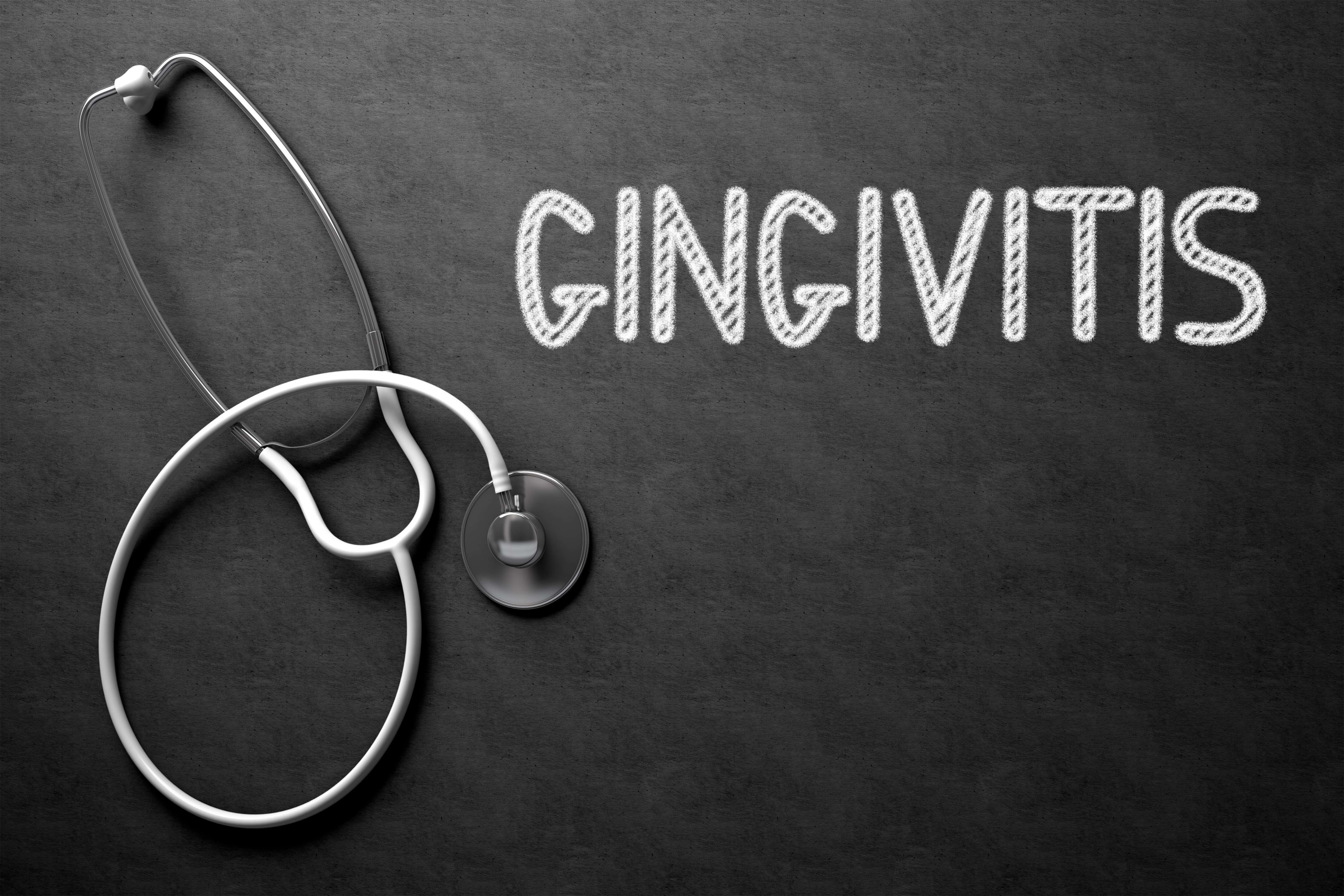 Gingivitis Symptoms, Causes & Treatment How Serious is it?