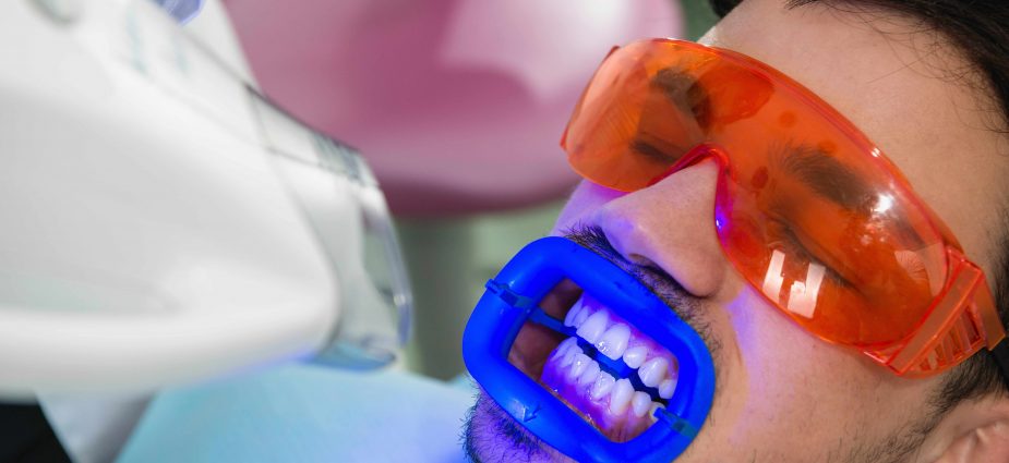 Cost Of Teeth Whitening At Dentist Office - TeethWalls