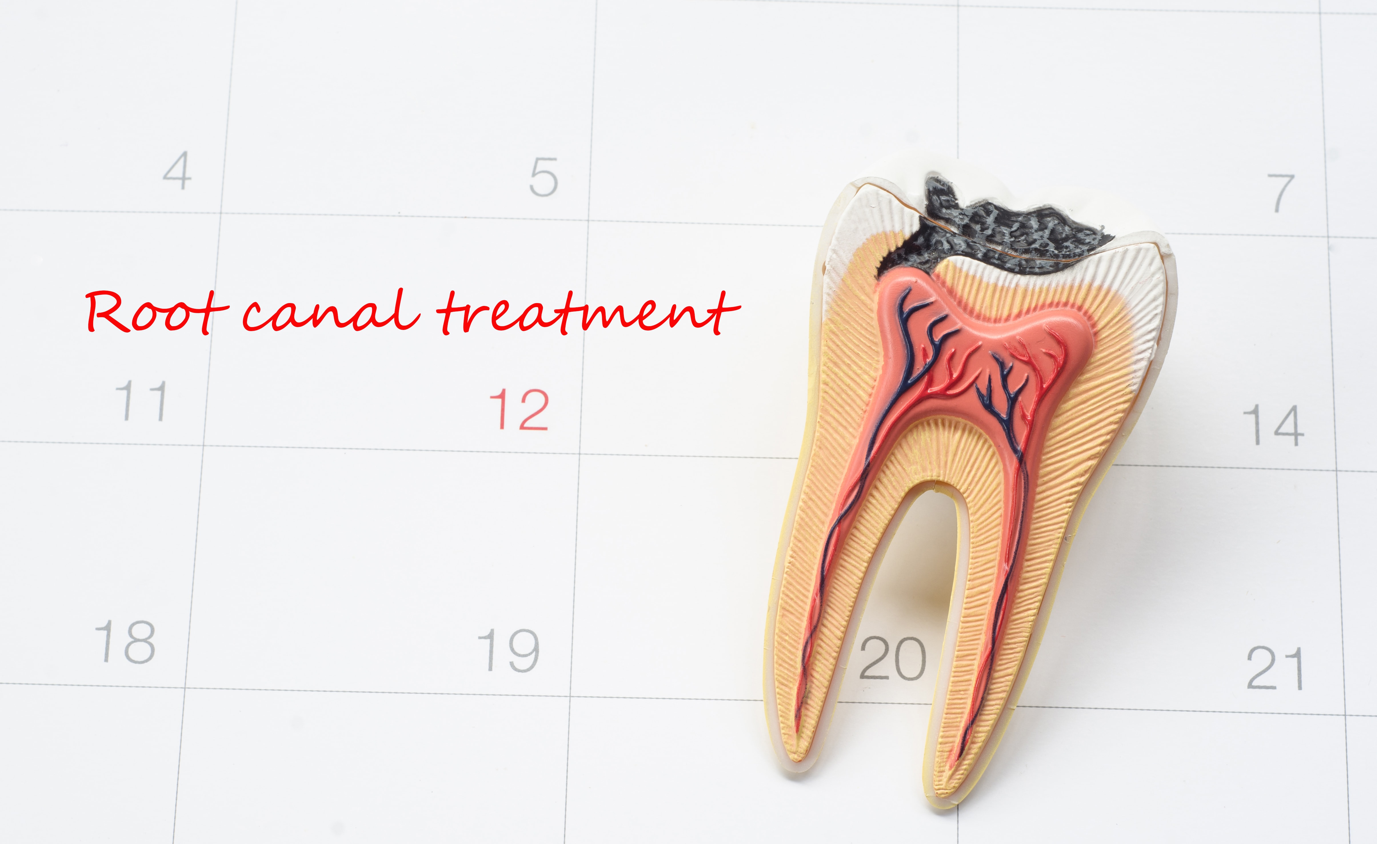 travel insurance root canal