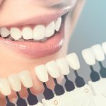 close up of a smiling woman measuring her tooth color with a shade guide