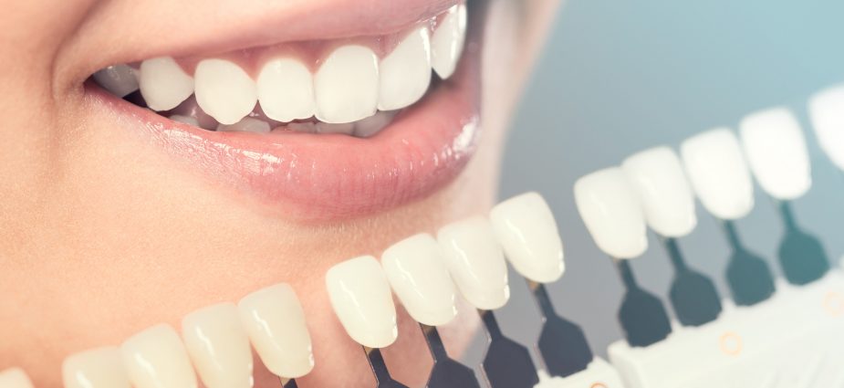 close up of a smiling woman measuring her tooth color with a shade guide