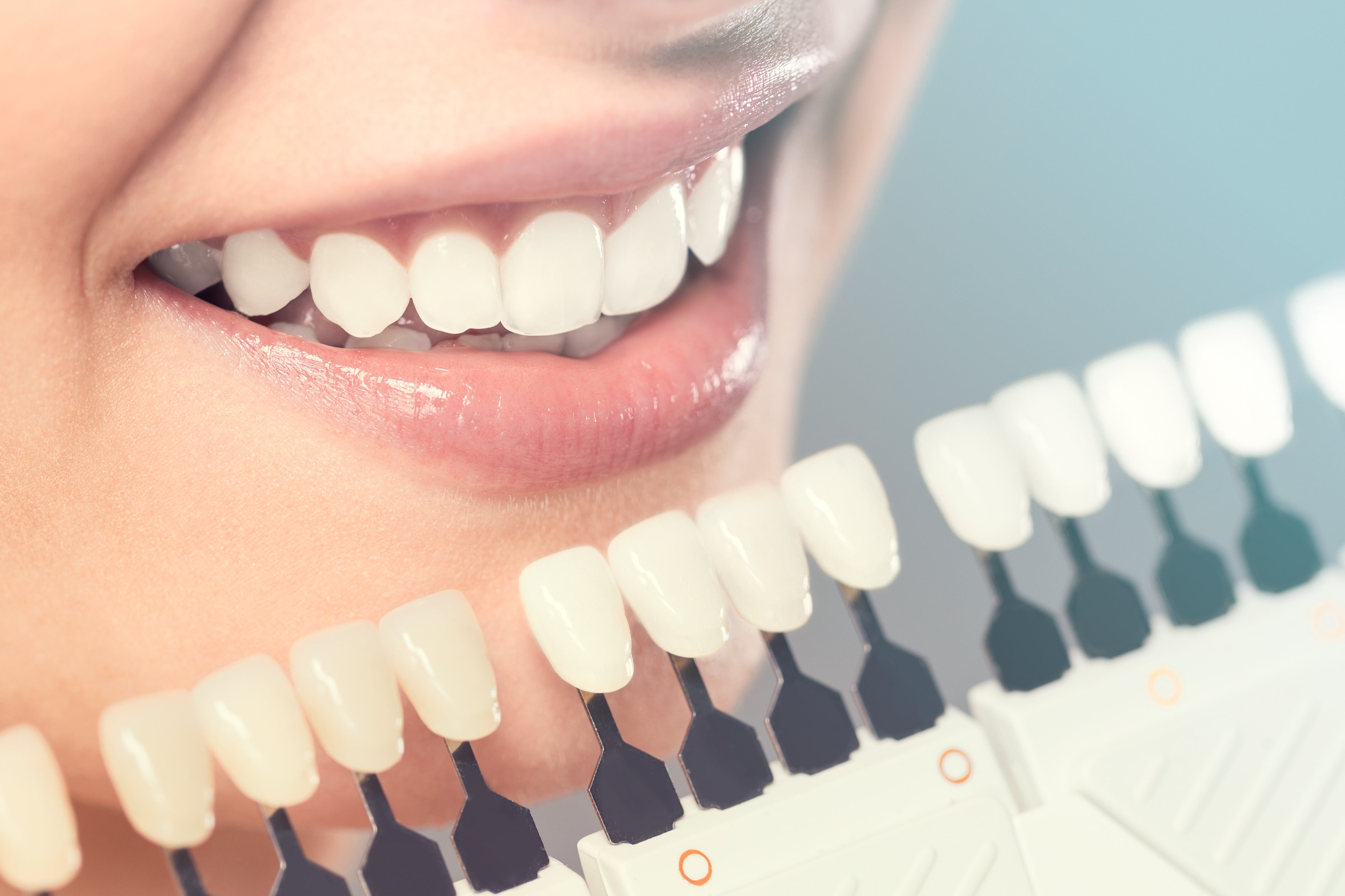 What Can Cosmetic Dentistry Do for Your Teeth?