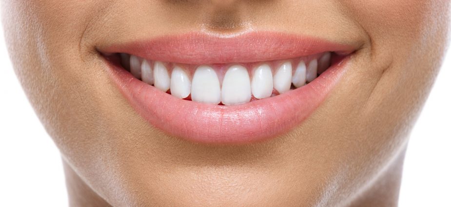 Image result for high smile line dental implant