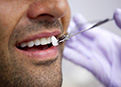 dental veneer patient evaluating treatment options