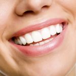 Close up of a smiling woman with perfectly whitened teeth