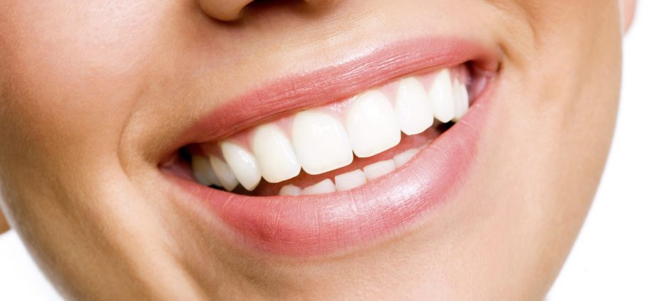 Close up of a smiling woman with perfectly whitened teeth