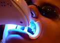 dental patient receiving light-activated teeth whitening in office