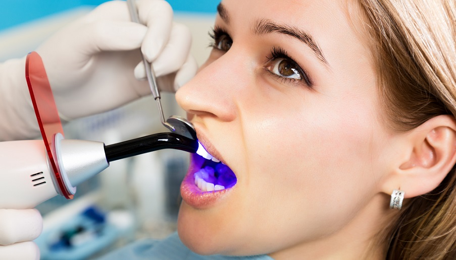 Dental Bonding vs Dental Crowns Consumer Guide to Dentistry