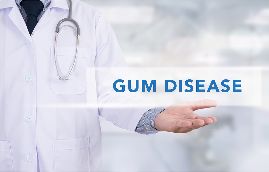 Gum Disease | Signs, Symptoms & Treatment Options