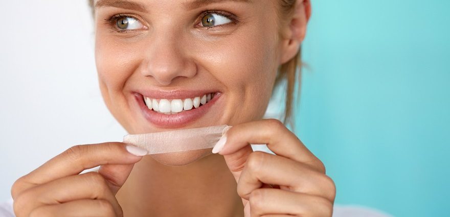At-home Teeth Whitening | How Do the Results Compare with the Pros?