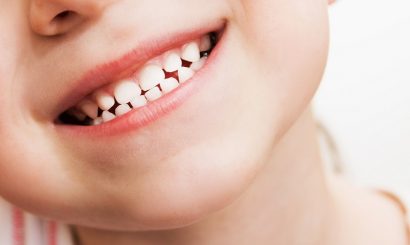 Smiling child with primary (baby) teeth