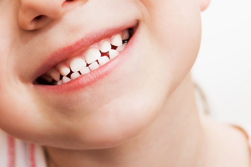 Smiling child with primary (baby) teeth