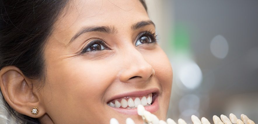 Smiling woman using shade guides for teeth whitening